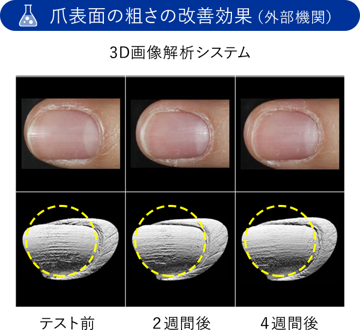 爪表面の粗さの改善効果（外部機関）3D画像解析システム